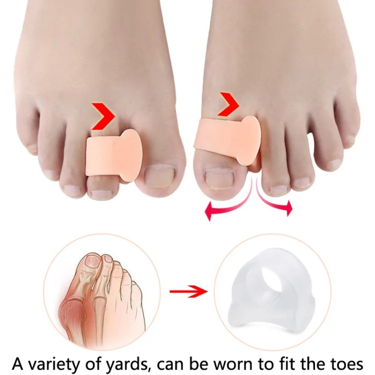 TBD0595743601_B3.webp 10 Pairs Great Toe Orthosis Separator Soft and Comfortable Toe Care Cover - Image 4