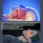 USB Rechargeable Smart Anti-snoring Device Home Snoring Corrector - Image 6