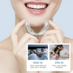 Sleeping Anti Snoring Mouth Guard Braces For Sleep Better Breath - Image 6