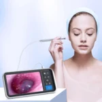 TESLONG MS450 4.5 inch HD Smart Screen Otoscope with 32GB Memory Card - Image 2