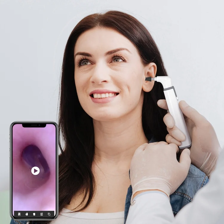 TBD0602682701_B5.webp TESLONG SA39W 3.9mm Camera Lens WiFi Smart Visual Ear Scoop - Image 6