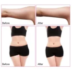 4 In 1  40K Ultrasonic Fat Blasting Device Radio Frequency Beauty Device - Image 6
