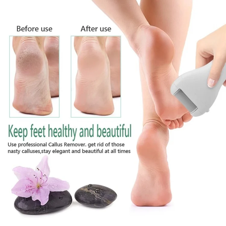 TBD0603084901_B5.webp Electric Foot Grinder Digital Display USB Pedicure Peeling - Image 6