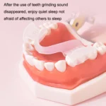 Y-Kelin Orthodontic Appliance Silicone Simulation Braces Anti-Molar Braces For Night - Image 4