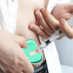 4pcs/set Injection Aid Tablet Press Firmly Can Relieve Pain Pain Blocker Device - Image 4