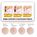 FY-106 Portable Mole and Freckle Removal Pen Household Laser Beauty Equipment - Image 4