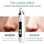 Blackhead Remover Vacuum Pore Cleaner Facial Deep Cleaning Beauty Tools - Image 6
