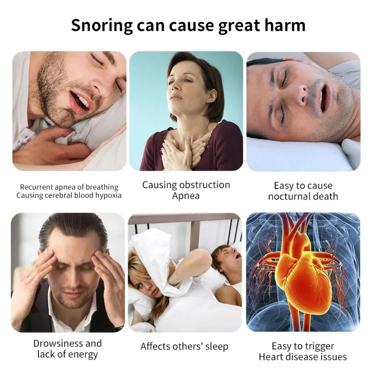 TBD06038379_B11.webp Smart Anti-snoring Device TENS Double Pulse Sound Wave Induction Sleep Snoring Breathing Corrector - Image 12