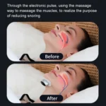 Smart Anti-snoring Device TENS Double Pulse Sound Wave Induction Sleep Snoring Breathing Corrector - Image 10