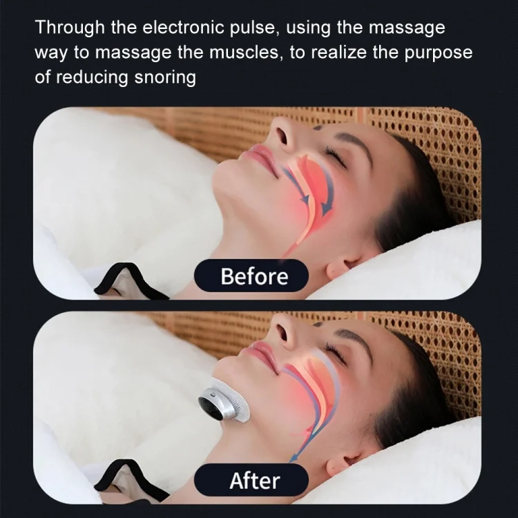TBD06038379_B9.webp Smart Anti-snoring Device TENS Double Pulse Sound Wave Induction Sleep Snoring Breathing Corrector - Image 10