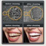 Ultrasonic Electric Dental Scaler Teeth Plaque Cleaner Dental Stone Removal With LED Light - Image 7