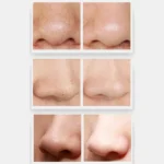 ZLY-018 Household Electric Blackhead Suction Device Pore Cleaning and Beauty Equipment - Image 7