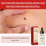 Ximonth 20ml/Bottle Anti Mole And Wart Liquid Dark Spot Tag Remover Skin Essence - Image 6