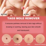 Ximonth 20ml/Bottle Anti Mole And Wart Liquid Dark Spot Tag Remover Skin Essence - Image 7