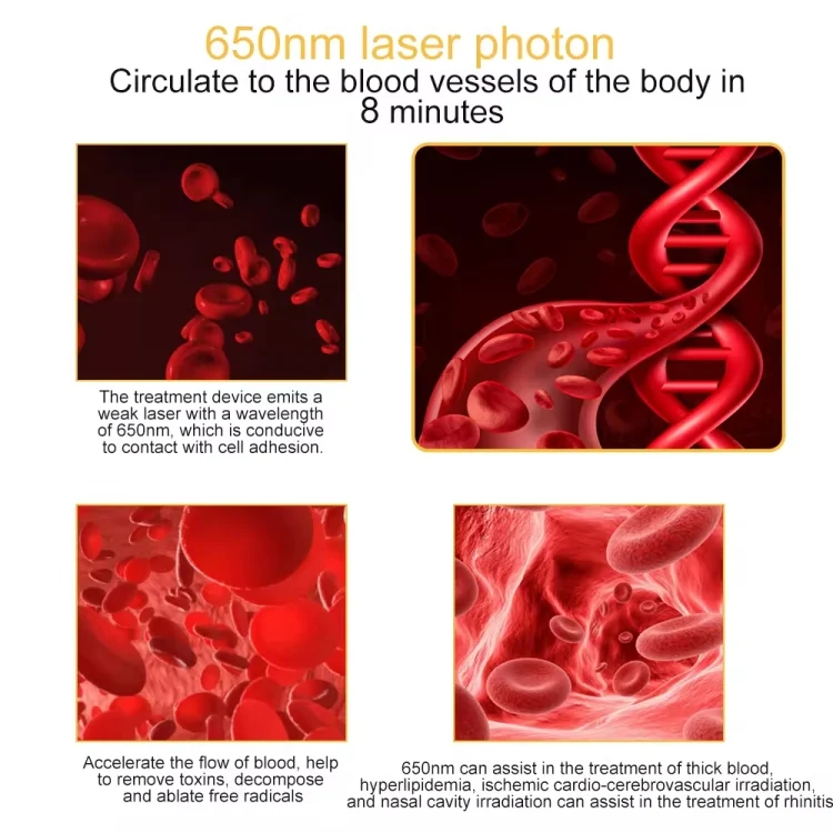 TBD06046316_3.webp 650nm Ear Laser Canal Irradiation Physiotherapy Instrument for Tympanitis Tinnitus Sudden Deafness - Image 4