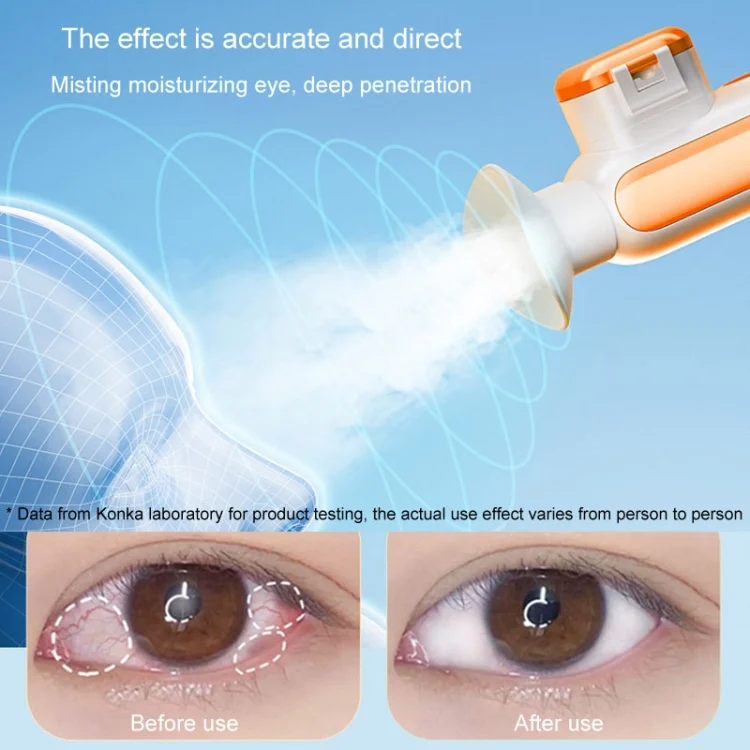 TBD06047784_B7.webp KONKA Hot And Cold Compress Misting Eye Moisturizer Spray Steamer Handheld Eye Misting Instrument - Image 8