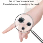 Fawnmum Braces Remover Invisible Orthodontic Removal Hook - Image 3