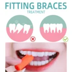 Fawnmum 2pcs /Box Handheld Hollow Cylinder Orthodontic Bite Sticks - Image 2