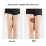 10pcs /Pack Invisible Thigh Stickers Sweat-proof and Friction-proof Thigh Pressure Relief Patches - Image 7
