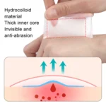 Square Hydrocolloid Dressing Tape Heel Self-Adhesive Blister Patch - Image 5