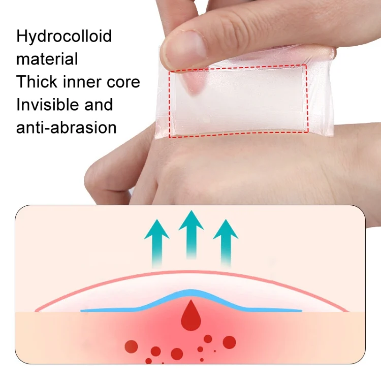 TBD06050982_B4.webp Square Hydrocolloid Dressing Tape Heel Self-Adhesive Blister Patch - Image 5