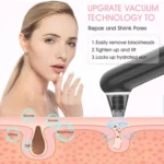 Electric Beauty Instrument Face Pore Remover Blackhead Acne Cleaner - Image 2