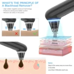 Electric Beauty Instrument Face Pore Remover Blackhead Acne Cleaner - Image 6