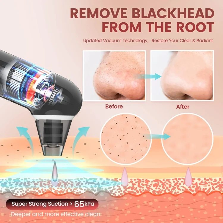 TBD06052972_B6.webp Electric Beauty Instrument Face Pore Remover Blackhead Acne Cleaner - Image 7