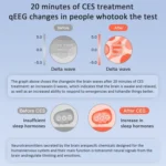 Ear Clip Sleep Aid Device Smart Microcurrent Pulse Pressure Relief Sleep Device - Image 7