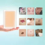 6pcs /Pack Ultra-Thin Water-resistant Tattoo Cover Stickers Scar & Birthmark Concealer Patches - Image 3
