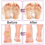 Electric Foot File Speed Adjustable Sandpaper Discs Callus Remover Pedicure Fast Remove Feet Hard Cracked Dry Dead Skin Tool - Image 11